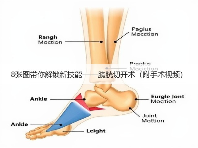 8张图带你解锁新技能——膀胱切开术(附手术视频)(图2) 8张图带你解锁新技能——膀胱切开术(附手术视频)(图2)
