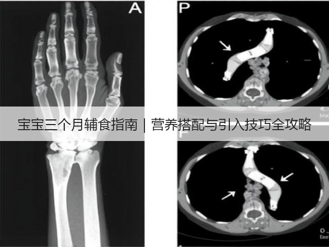 宝宝三个月辅食指南|营养搭配与引入技巧全攻略(图2) 宝宝三个月辅食指南|营养搭配与引入技巧全攻略(图2)