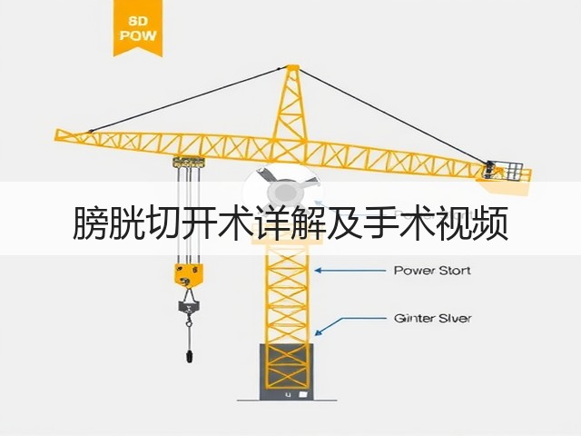 膀胱切开术详解及手术视频(图3) 膀胱切开术详解及手术视频(图3)