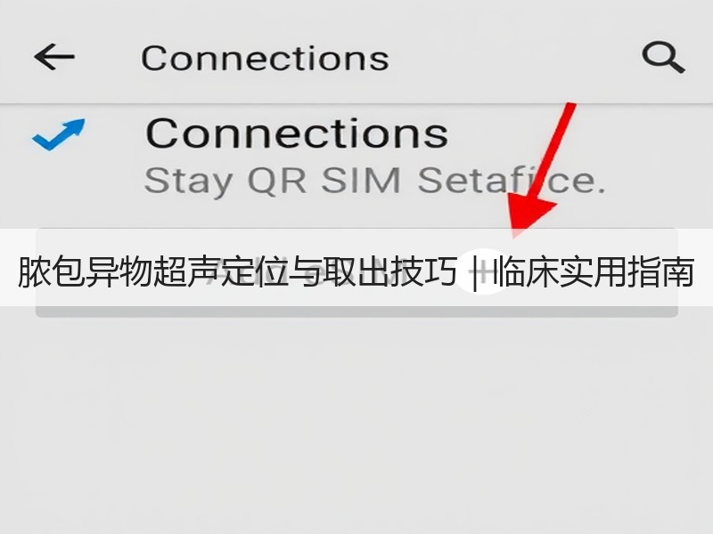 脓包异物超声定位与取出技巧｜临床实用指南